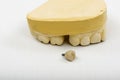 Dental Impression, Crown Implant, Royalty Free Stock Photo
